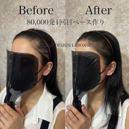 【テスト】【無料相談】スカルプデザインラボ｜薄毛のお悩みカウンセリング