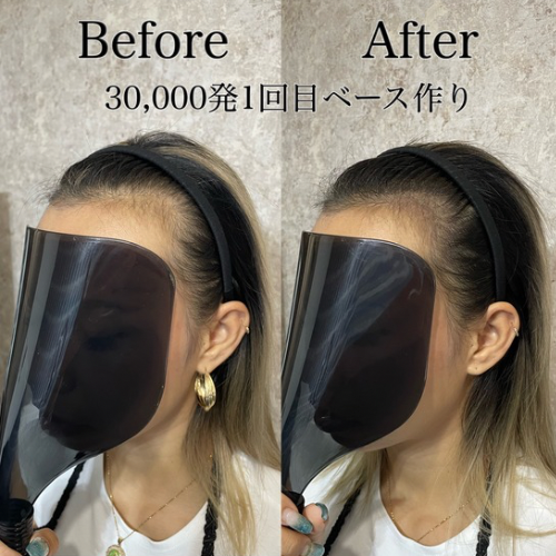 【テスト】【無料相談】スカルプデザインラボ｜薄毛のお悩みカウンセリング